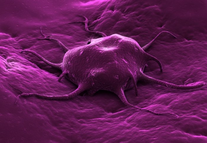 Picture of a cancer cell