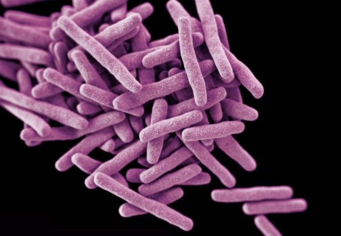 Mycobacterium tuberculosis bacteria. Credit: CDC/ Melissa Brower