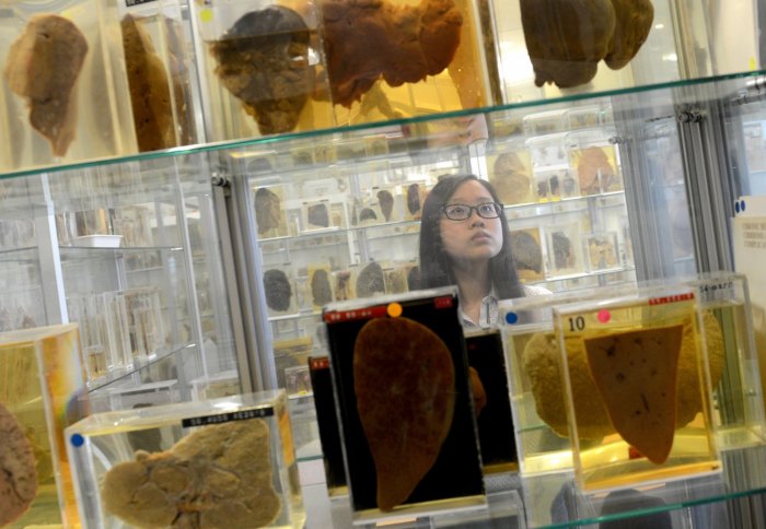 Human pathology and anatomy specimens donated to Singapore