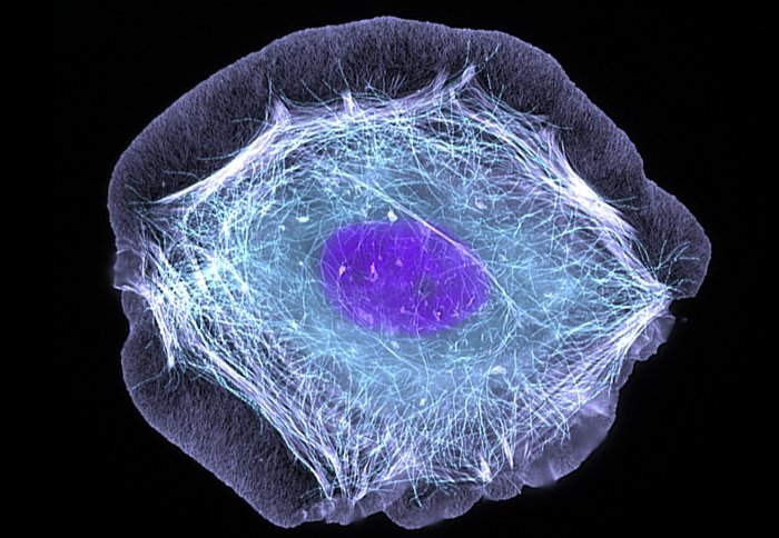 Skin cell (keratinocyte) by ZEISS microscopy