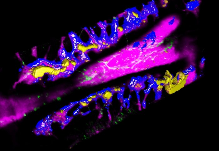 Purple and blue areas in the shape of bone with yellow patches throughout