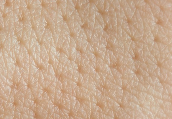 New Insights Into Skin Cells Could Explain Why Our Skin Doesnt Leak Imperial News Imperial