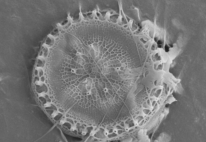 A cross section of a diatom, which looks like it is made from intricate lacework