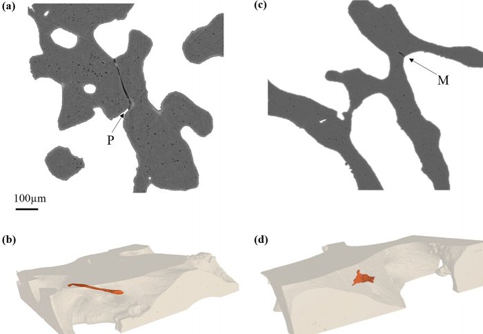 Microcracks in the bone