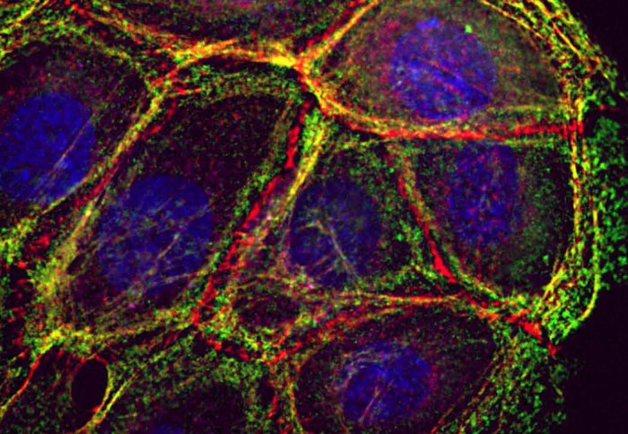 epithelial cells