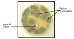 A. fumigatus compared to Atypical mould